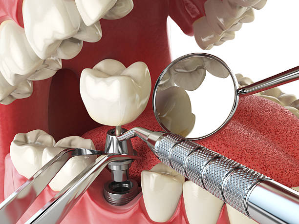 Best Emergency Dental Care for Trauma or Injury in Inglenook, CT